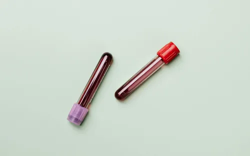 What Is PRP Therapy? How Your Own Blood Can Rejuvenate Your Skin & Hair