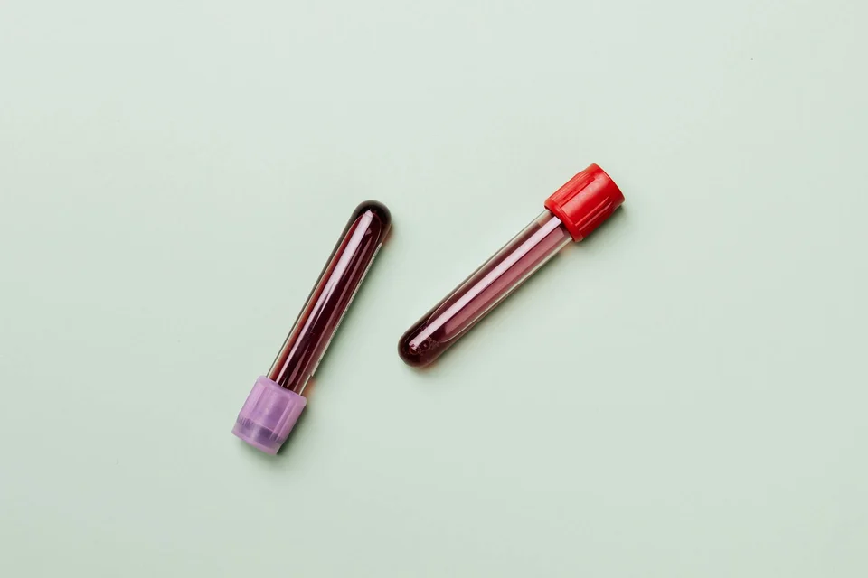 What Is PRP Therapy? How Your Own Blood Can Rejuvenate Your Skin & Hair